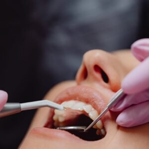 Close-up of dental procedure highlighting hygiene and patient care.